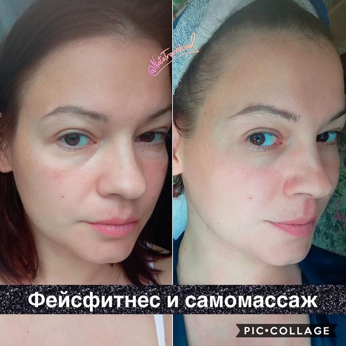 Фейсфитнес и самомассаж. Наталья Травникова